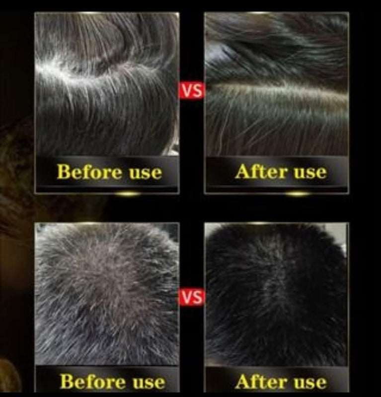 BLOSDREAM Black Hair Shampoo 3 in 1 ✨✨✨